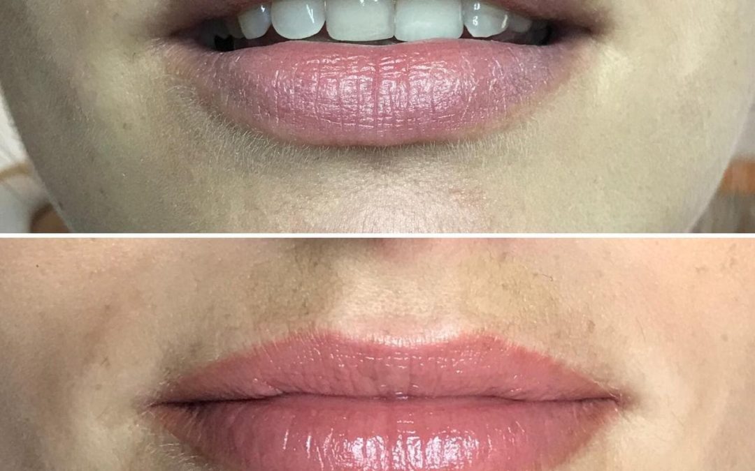 Permanent Lip Colouration